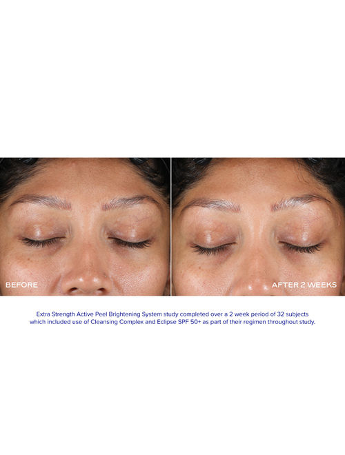 Extra Strength Active Peel Brightening System
