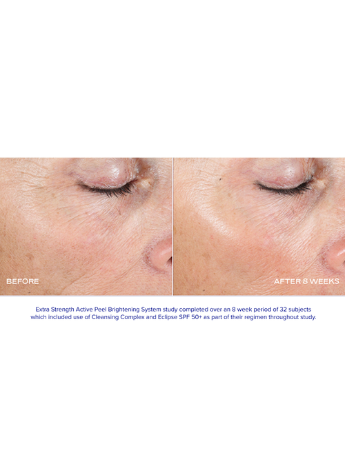 Extra Strength Active Peel Brightening System